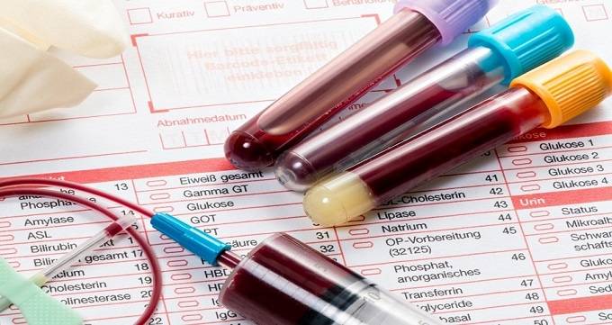 نقش آزمایش خون در تشخیص انواع سرطان