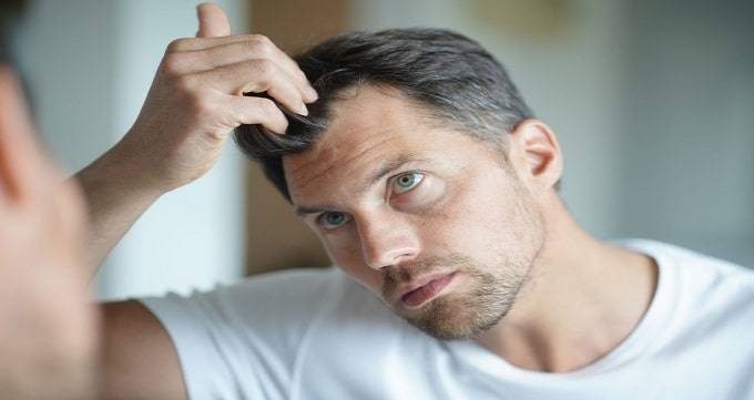 تفاوت ریزش مو در زنان و مردان