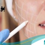 10 تا از بهترین دکتر بوکال فت در اصفهان【سال1405】❤️