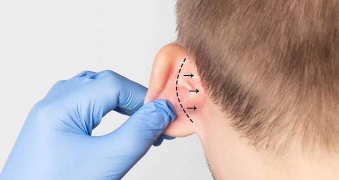 عوارض جراحی گوش