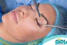 بهترین جراح زیبایی پلک در ایران