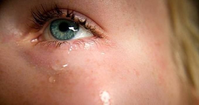 علت اشک ریزش و جراحی مجرای اشکی
