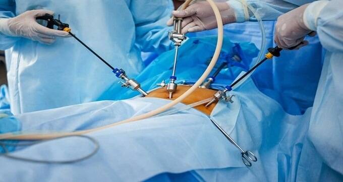 توصیه های قبل و پس از حراحی توسط بهترین جراح چاقی در ایران