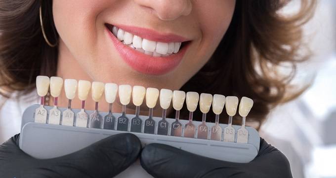 هزینه خدمات دندانپزشکی زیبایی