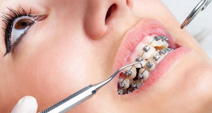تفاوت دکتر ارتودنسی با دندانپزشک عمومی