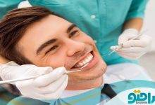 4 مزایا عصب کشی دندان