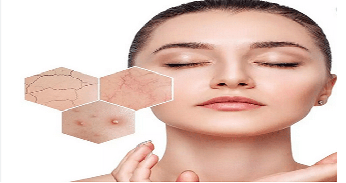 روش های مناسب پیشگیری از خشکی پوست صورت