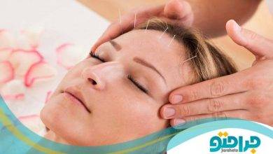 بهترین دکتر طب سوزنی در ایران