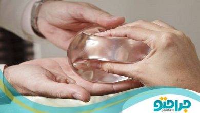 بهترین جراح پروتز باسن در ایران