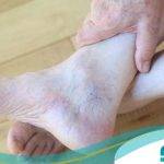 10 تا از بهترین مرکز درمان واریس در ایران【سال1404】❤️