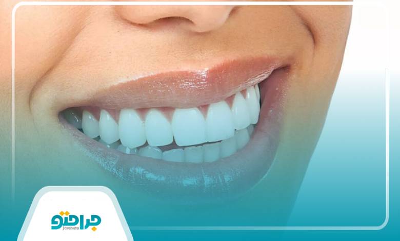 توصیه های بهترین دکتر کامپوزیت در اصفهان