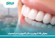 بهترین دکتر کامپوزیت در اصفهان