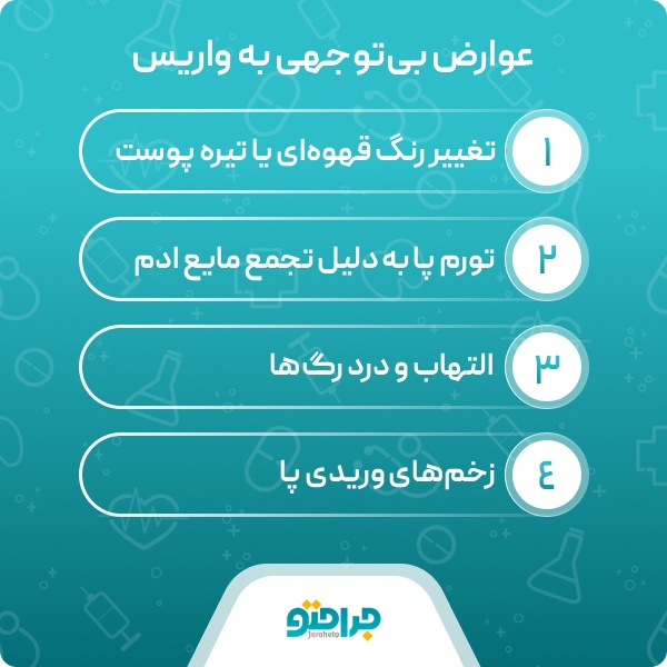 واریس چیست؟