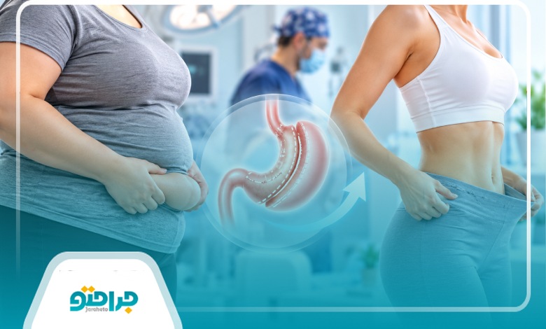 مراقبتهای ضروری بعد از جراحی چاقی