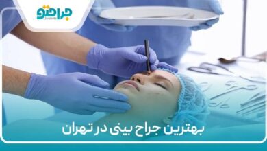 بهترین جراح بینی در تهران