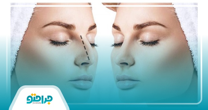 بهترین جراح بینی در تهران در چه زمینه هایی تخصص دارد؟