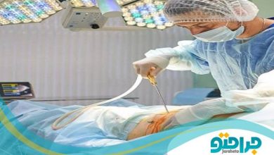 بهترین جراح ابدومینوپلاستی در تبریز