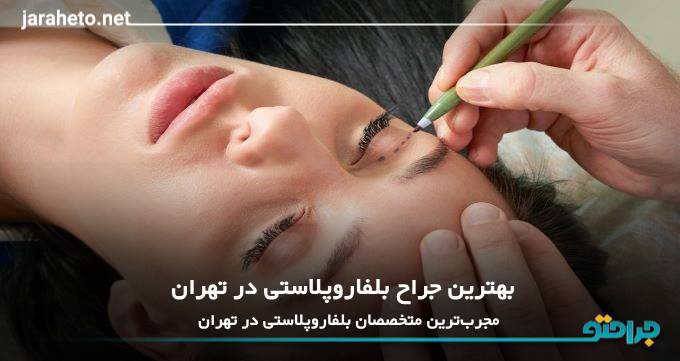 بهترین جراح بلفاروپلاستی در تهران