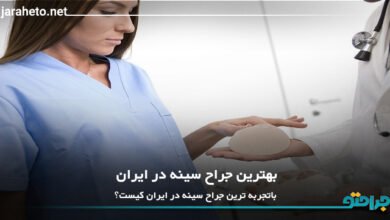بهترین جراح سینه در ایران