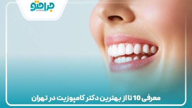 معرفی 10 تا از بهترین دکتر کامپوزیت در تهران
