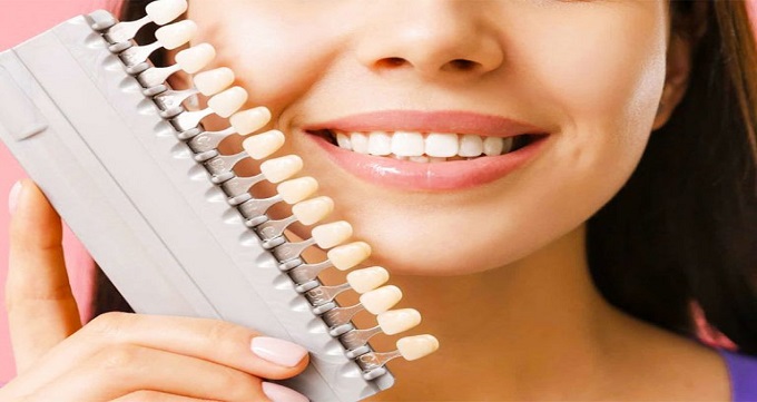 کامپوزیت برای بهبود زیبایی دندان ها