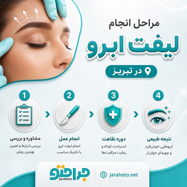 روش‌های جراحی لیفت ابرو