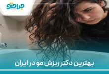 بهترین دکتر ریزش مو در ایران
