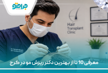 معرفی 10 تا از بهترین دکتر ریزش مو در کرج
