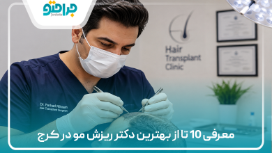 معرفی 10 تا از بهترین دکتر ریزش مو در کرج