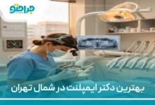 بهترین دکتر ایمپلنت در شمال تهران