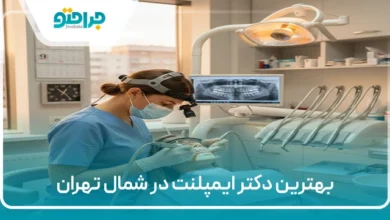 بهترین دکتر ایمپلنت در شمال تهران
