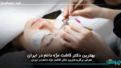 بهترین دکتر کاشت مژه دائم در ایران