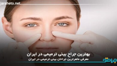 بهترین جراح بینی ترمیمی در ایران