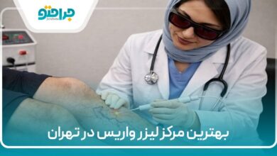 بهترین مرکز لیزر واریس در تهران