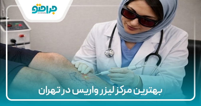 بهترین مرکز لیزر واریس در تهران
