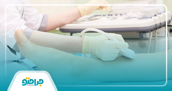 عوارض تشخیص دیر هنگام واریس