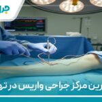 10 تا از بهترین مرکز جراحی واریس در تهران⭐【سال 1404】❤️