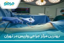 بهترین مرکز جراحی واریس در تهران