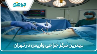 بهترین مرکز جراحی واریس در تهران