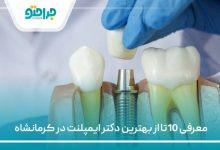 10 تا از بهترین دکتر ایمپلنت در کرمانشاه