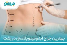 بهترین جراح ابدومینوپلاستی در رشت