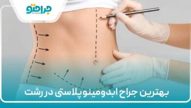 بهترین جراح ابدومینوپلاستی در رشت