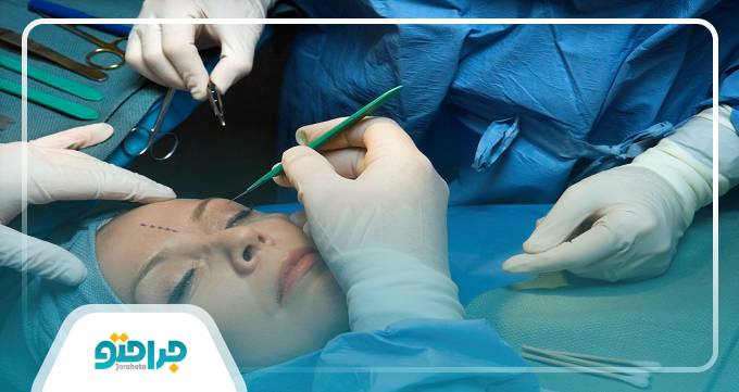 مراقبت های قبل و بعد از جراحی پلاستیک