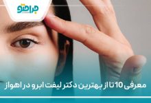 10 تا از بهترین دکتر لیفت ابرو در اهواز