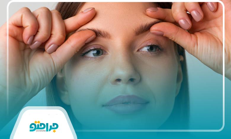 10 تا از بهترین دکتر لیفت ابرو در اهواز