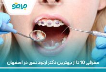 معرفی 10 تا از بهترین دکتر ارتودنسی در اصفهان