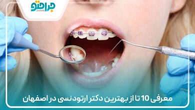 معرفی 10 تا از بهترین دکتر ارتودنسی در اصفهان