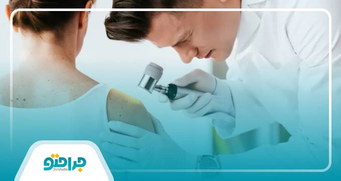 انواع پوست از نظر بهترین دکتر پوست و مو در تهران