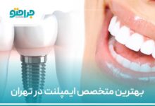 بهترین متخصص ایمپلنت در تهران