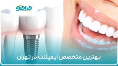 بهترین متخصص ایمپلنت در تهران